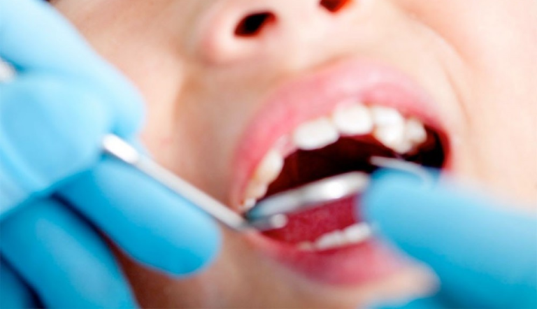 Эрт илрүүлэгт хамрагдсан 1-р ангийн сурагчдын 83% нь шүдний өвчлөлтэй байна