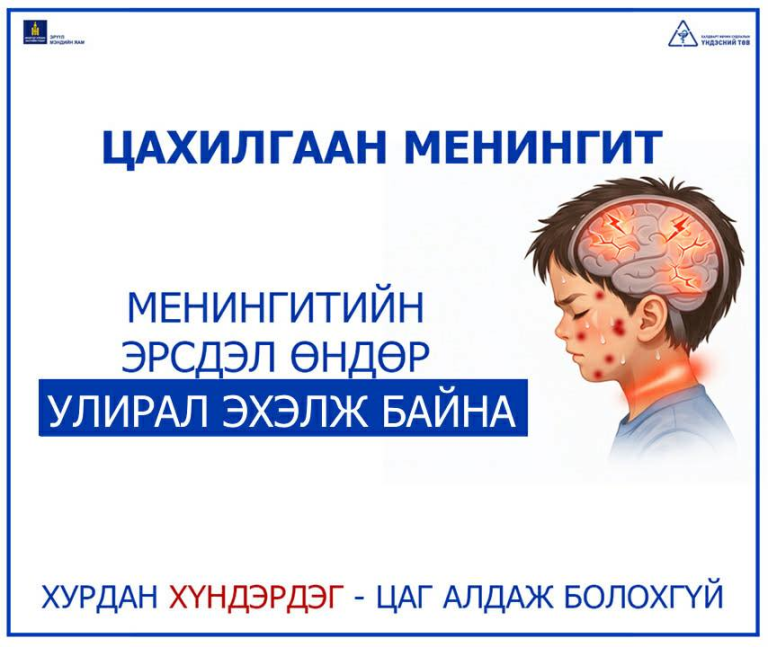 ЭМЯ: Менингитийн эрсдэл өндөр улирал эхэлж байна